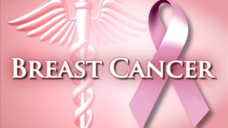 Breast Cancer