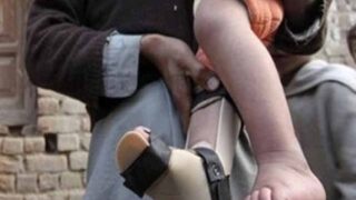 Polio Cases