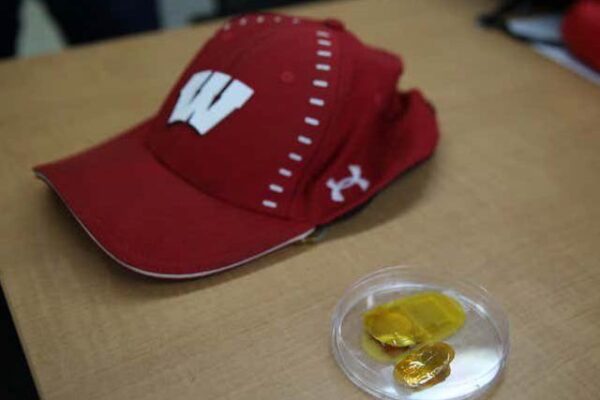 گنج پن دور کرنے والی انوکھی بجلی بھری ٹوپی