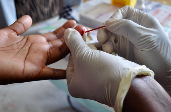 ایڈز HIV کے مریضوں سے پیار