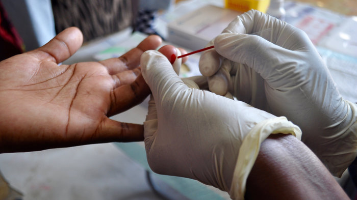 AIDS Patients
