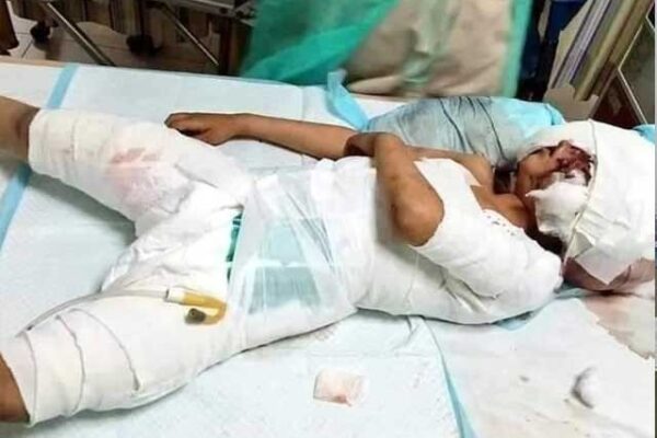 لاڑکانہ میں کتوں کے حملے میں شدید زخمی 6 سالہ حسنین دم توڑ گیا