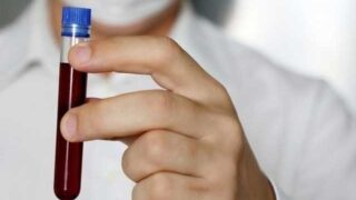 Corona Virus