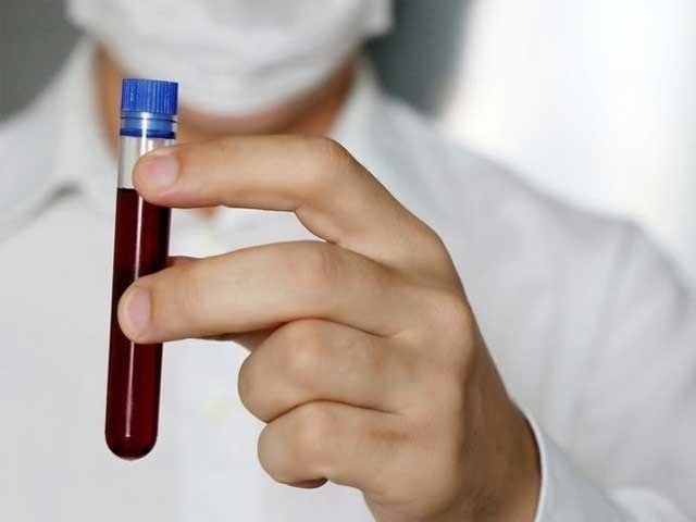 Corona Virus
