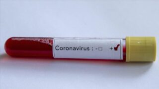 Coronavirus