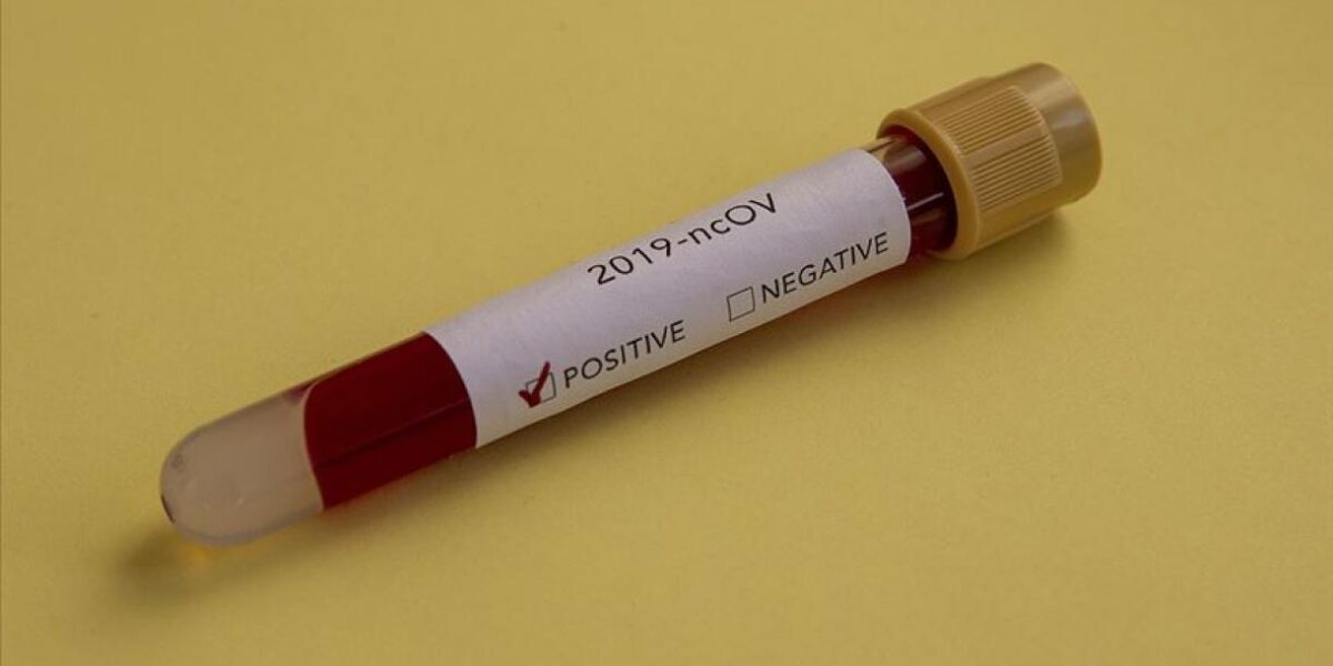 Coronavirus