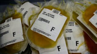 Plasma Therapy