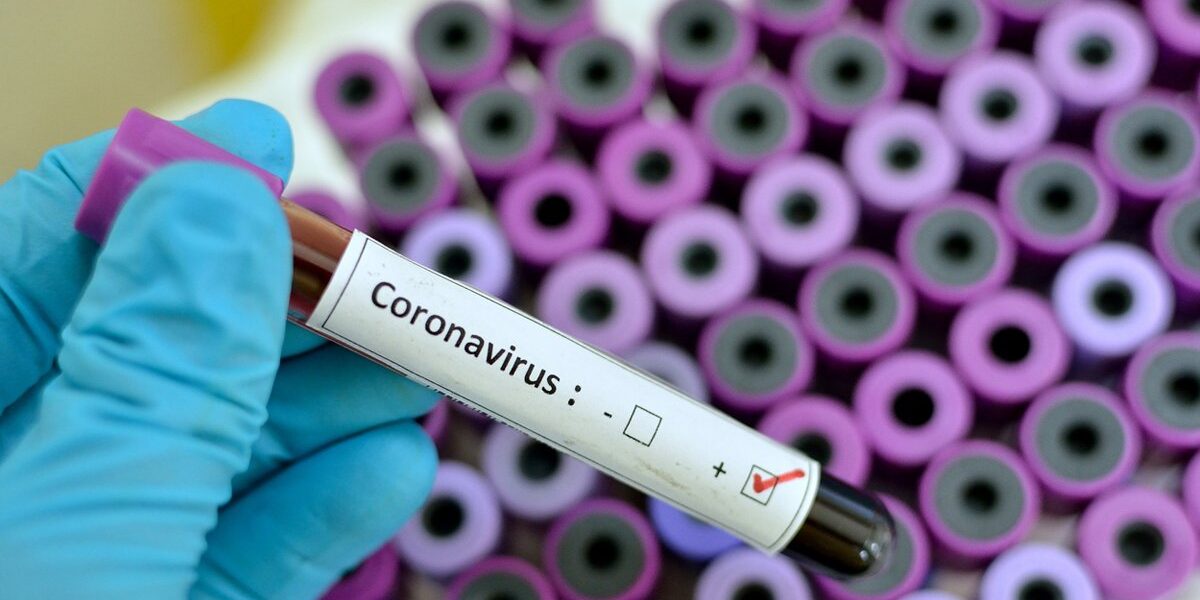 Coronavirus Test