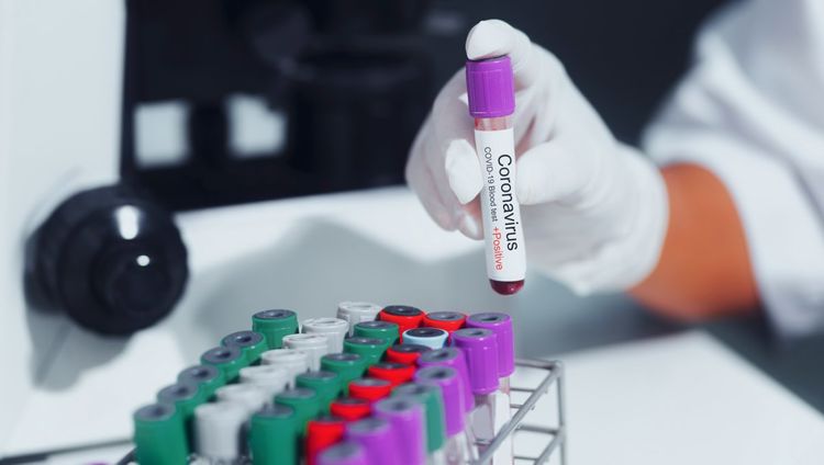 Coronavirus