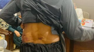 Journalist Matteen Achakzai