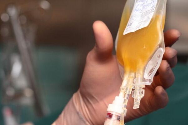 پنجاب میں کورونا مریضوں کیلئے بلا اجازت پلازما ٹرانس فیوژن پر پابندی عائد