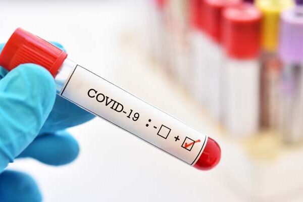 کووڈ 19 صرف سانس یا پھیپھڑوں کی ہی بیماری نہیں: ماہرین