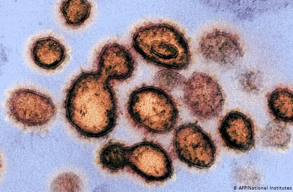 کورونا کی معمولی علامات کے باوجود دماغ کو شدید نقصان ہو سکتا ہے، تحقیق