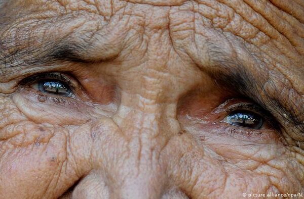 اندھے پن کا علاج، سائنسدان کے لیے 1 ملین یورو کا انعام