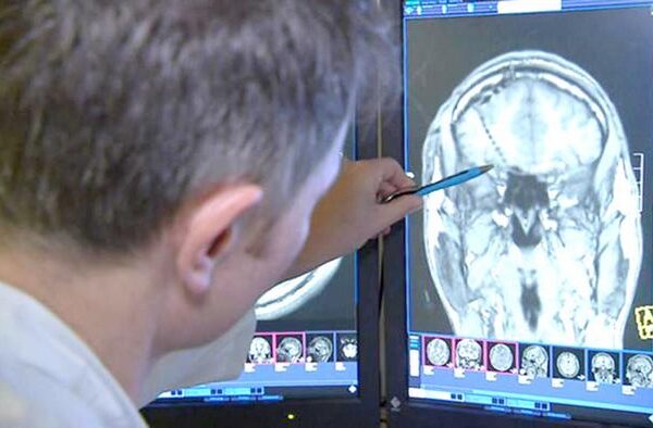 مرگی کے علاج کے لیے جدید تحقیق