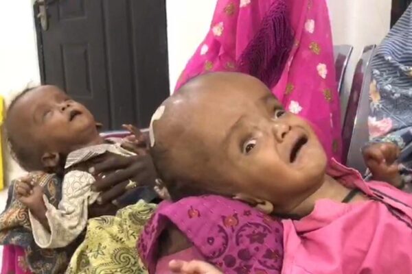تھر: پانی کی کمی اور غذائی قلت کے باعث کمزور دماغ کے بچوں کی پیدائش میں اضافہ