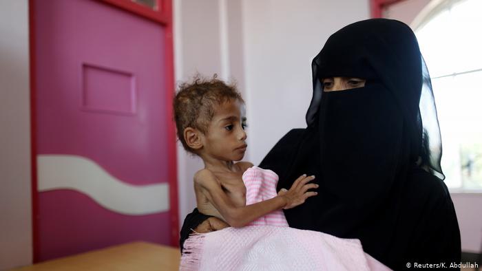 Yemeni Children