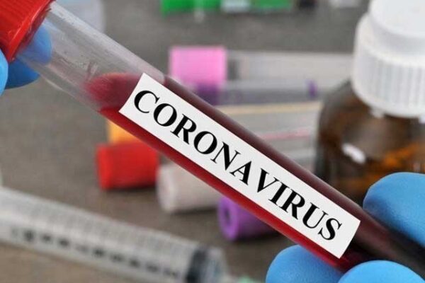 ملک میں مزید 1 ہزار 772 افراد میں کورونا کی تشخیص