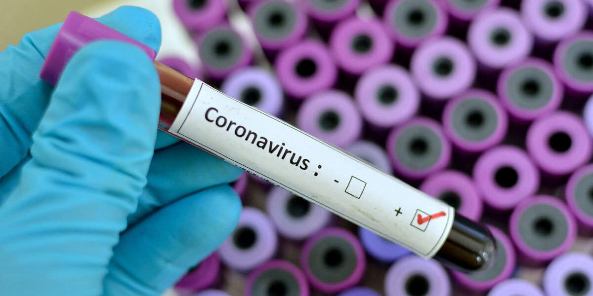 Coronavirus