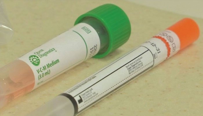 Corona Testing Kits