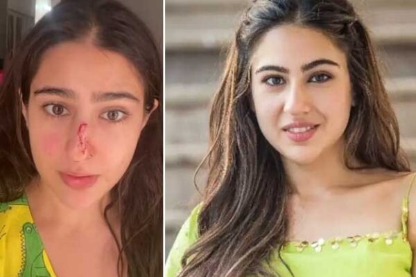 اداکارہ سارہ علی خان نے اپنی ناک کاٹ ڈالی