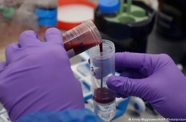 برطانیہ میں کینسر کے انقلابی کلینیکل ٹیسٹ کا آغاز