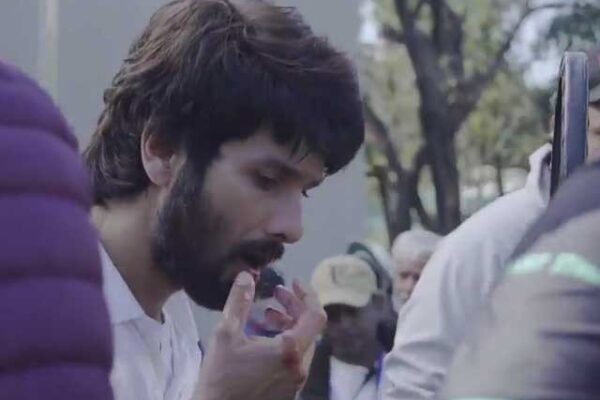 شاہد کپور شوٹنگ کے دوران چہرے پر گیند لگنے سے زخمی، 25 ٹانکے آئے