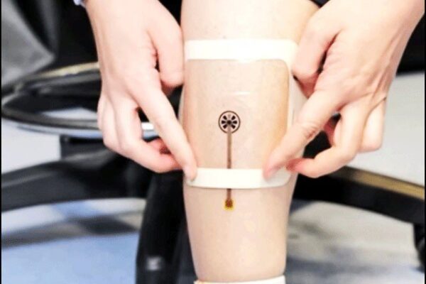 پرانے اور گہرے زخموں پر نظر رکھنے والی ’ذہین‘ پٹی