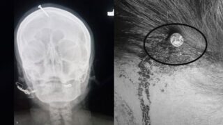 Head Nail