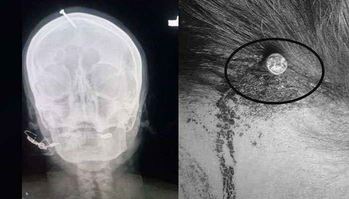Head Nail