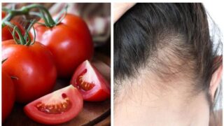 **ٹماٹر: بالوں کی نشوونما اور گنج پن کا قدرتی علاج**&hellip;