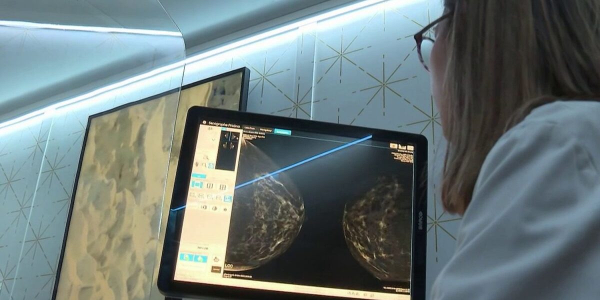 breast-cancer-screening-age-reduction-proposal