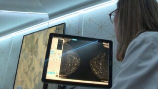 breast-cancer-screening-age-reduction-proposal