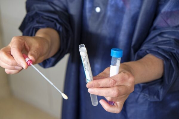 فرانس میں فارمیسیز میں کووڈ-19 ٹیسٹ مارچ 2025 سے مفت نہیں ہوں گے