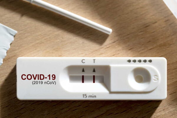 کورونا کا نیا ‘فرینکنسٹائن’ ویرینٹ: ماہرین نے معمولی علامات کے بارے میں خبردار کر دیا