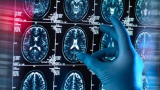 Deep Sleep May Shield Brain from Alzheimer's, Study Finds