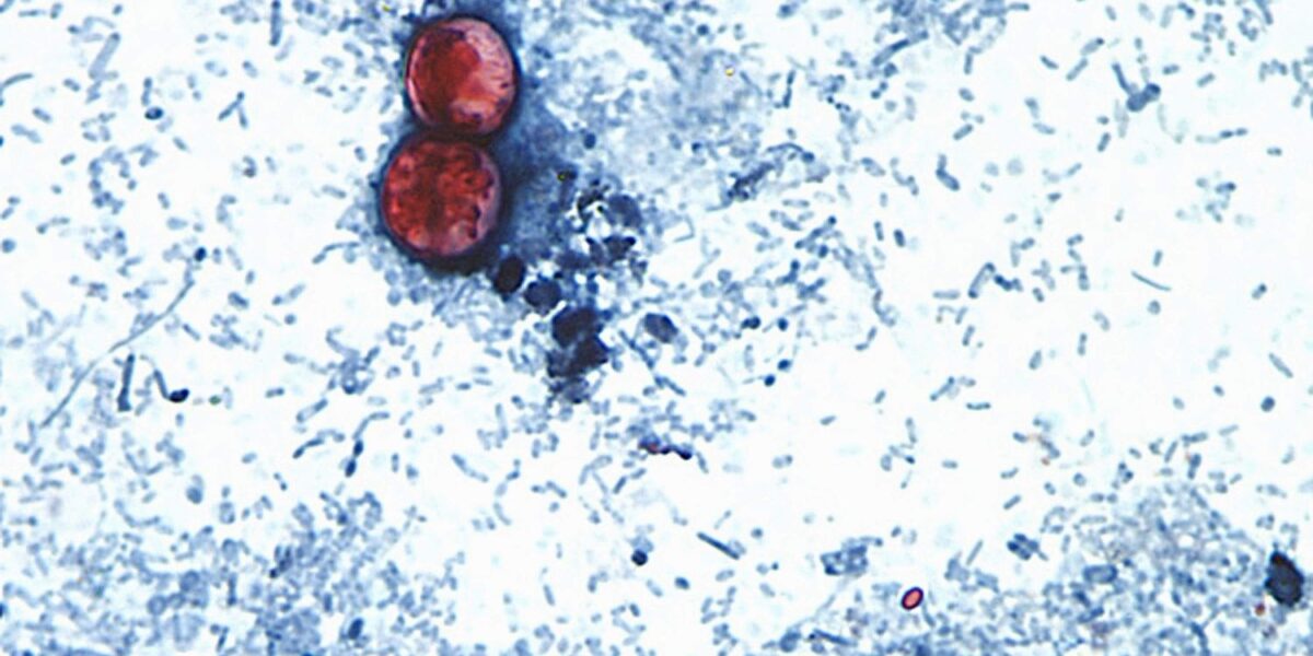 FDA Closes Investigation into "Explosive Diarrhea" Outbreak, Traces Parasite to Mexican Lettuce Operations